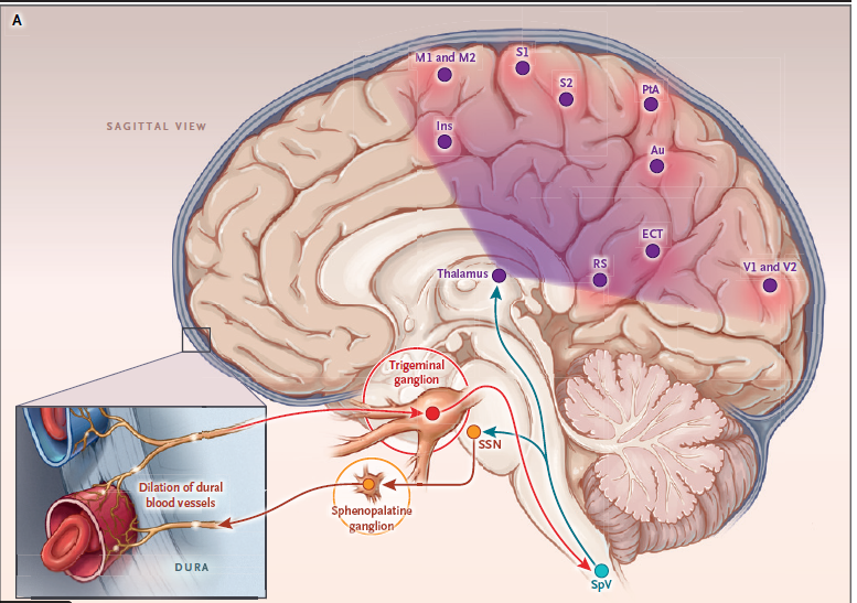 Áreas cerebrais envolvidas com a patogênese da enxaqueca    